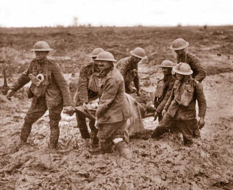 Soldat anglais blessé à  Passchendaele août 1917 